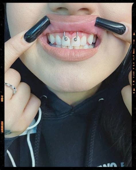 Important: Read This Before Getting Smiley Piercings